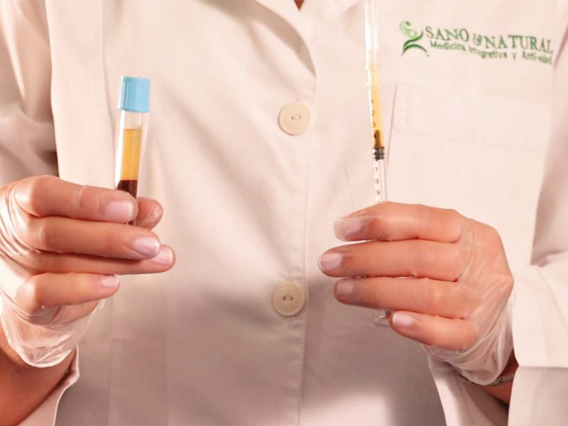 Plasma rico en factores de crecimiento 800x600